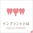 インプラントとは